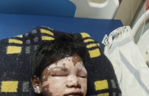 छात्रावासों में बच्चों की जान की कीमत पर भ्रष्टाचार