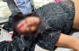 सड़क हादसे में महिला पत्रकार गंभीर रूप से घायल, ट्रक चालक फरार