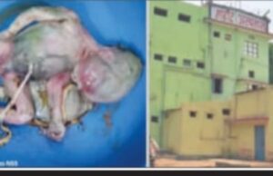 शहीद अस्पताल के बाथरूम में मिला नवजात शिशु का शव