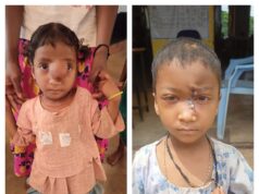 ‘चिरायु’ से अंजलि को दी नई सूरत और लंबी आयु