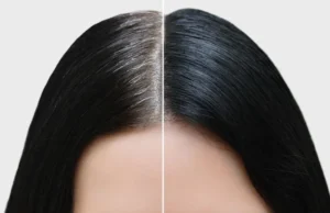 सफेद बालों को काला करने का आसान घरेलू नुस्खा: नारियल तेल और करी पत्तों से पाए स्वस्थ और घने बाल