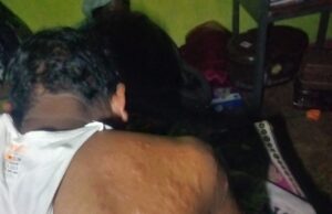 बेमौसम तूफान का कहर: आंधी-ओलावृष्टि में दंपत्ति घायल, एक-दूसरे को थामकर बचाई जान