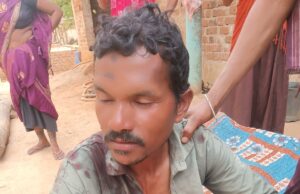 आपसी लड़ाई के बीच एक अन्य व्यक्ति पर टांगी से हमला, मामला दर्ज