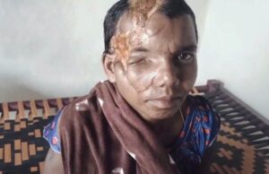 मानवता और संवेदनशील प्रशासन की मिसाल : भालू हमले की पीड़िता प्रेमबाई के घर पहुंचेगा जिला मेडिकल बोर्ड