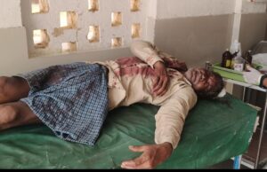 जमीन में बंटवारा मांगने को लेकर पिता ने बेटे पर टांगी से प्राण घातक हमला कर किया घायल गंभीर अवस्था मे जिला अस्पताल रेफर।