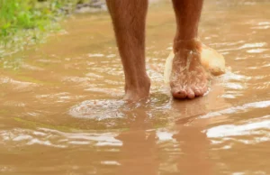 मानसून अलर्ट: सड़क पर जमा पानी बन सकता है गंभीर बीमारियों की वजह