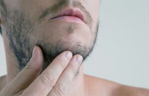 घनी दाढ़ी पाने का आसान तरीका! ये 4 उपाय बढ़ाएंगे Beard Growth, दिखेगा शानदार बदलाव
