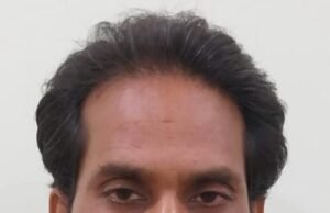 5 माह का वेतन जारी करने के एवज में 1 लाख रुपये रिश्वत लेते सक्ती के सिविल सर्जन एसीबी के ट्रैप में गिरफ्तार