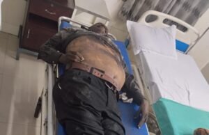 कुसमुंडा खदान क्षेत्र में दर्दनाक हादसा: अज्ञात वाहन की चपेट में आने से ठेका श्रमिक की मौत, परिजनों ने मुआवजे की मांग को लेकर खोला मोर्चा