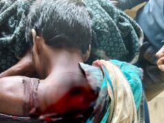 कर्मा उत्सव देख रहे युवक पर टंगिया से हमला, आरोपी गिरफ्तार