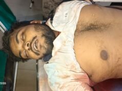 कोरबा पुलिस का बड़ा एक्शन: मुड़ापार रावण दहन में मंत्री के आगमन से पूर्व हुई ‘गोल्डन’ की हत्या का 2 घंटे में पर्दाफाश; पुलिस की रात भर की मुस्तैदी से 3 आरोपी गिरफ्तार, 1 फरार